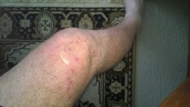 Right Leg.jpg Right Leg.jpg